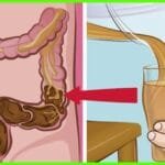 أفضل حبوب تنظيف القولون من الصيدلية