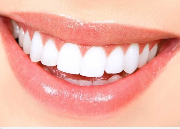 تجربتي مع لصقات كرست بروفيشنال طريقة الاستخدام