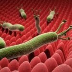 علاج جرثومة المعدة نهائيا