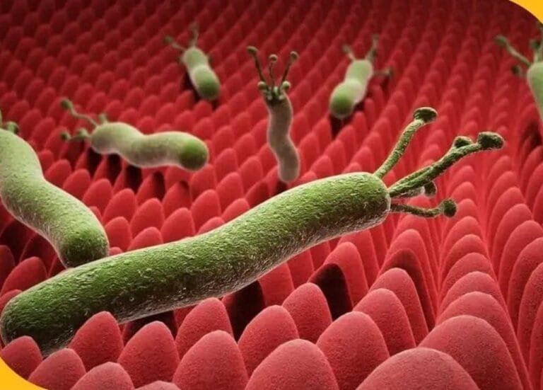 علاج جرثومة المعدة نهائيا