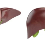 تجربتي في تفتيت حصوة المرارة بدون جراحة