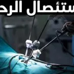 تجربتي مع استئصال الرحم وآثاره الجانبية